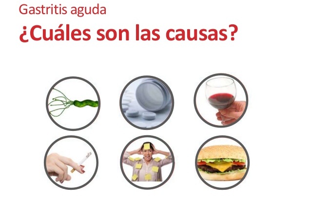 Gastritis Aguda Gastritis Aguda